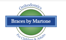 Braces by Martone