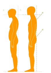 Alexander Technique
