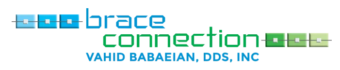 Brace Connection